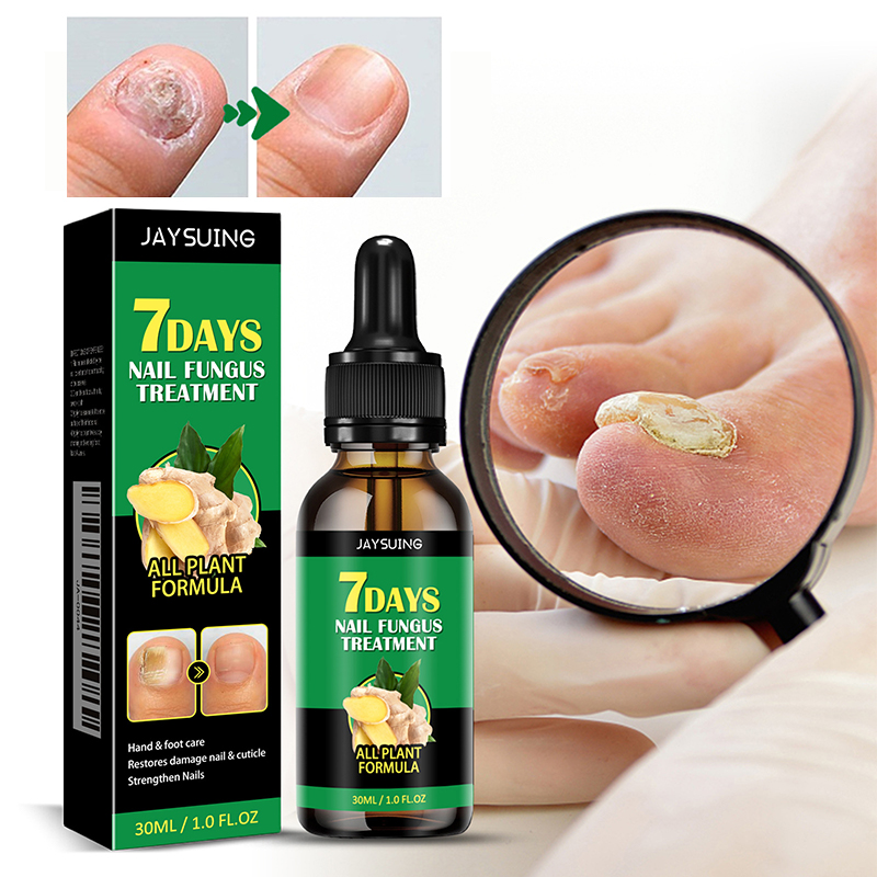 Ingwer-Nagelbehandlung
