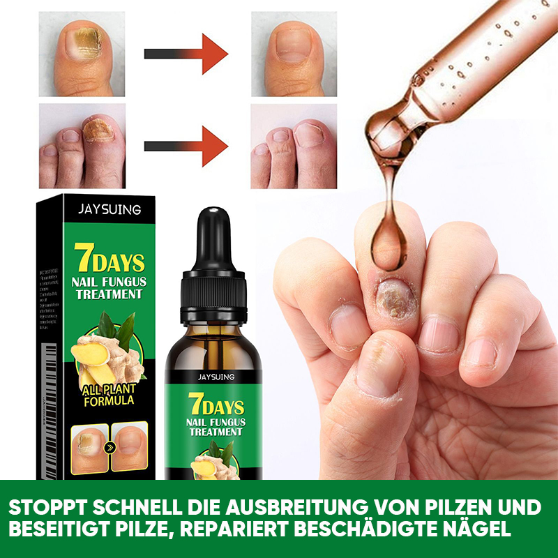 Ingwer-Nagelbehandlung