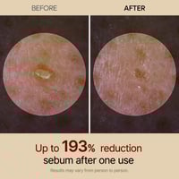 Gentle Exfoliating Ampoule – Black Rice