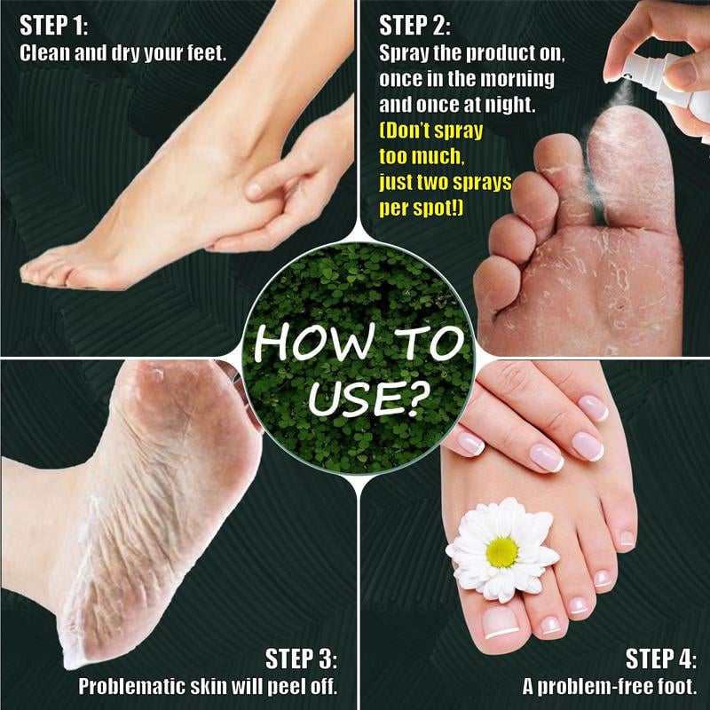 Feet Callus Remover