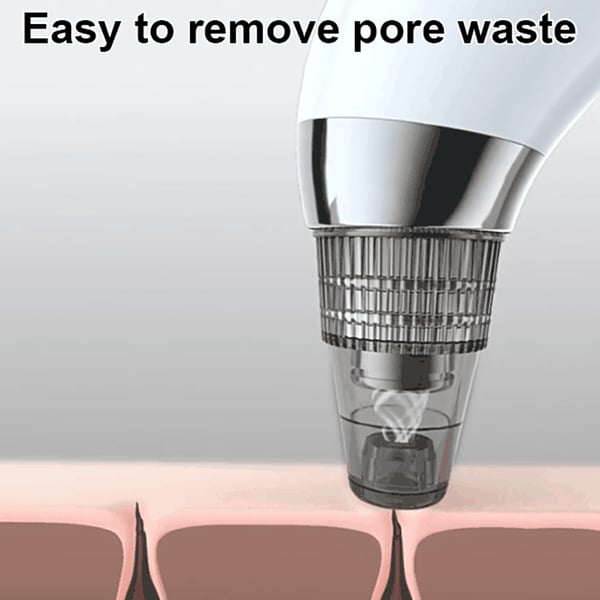 Vacuum Blackhead Remover Set
