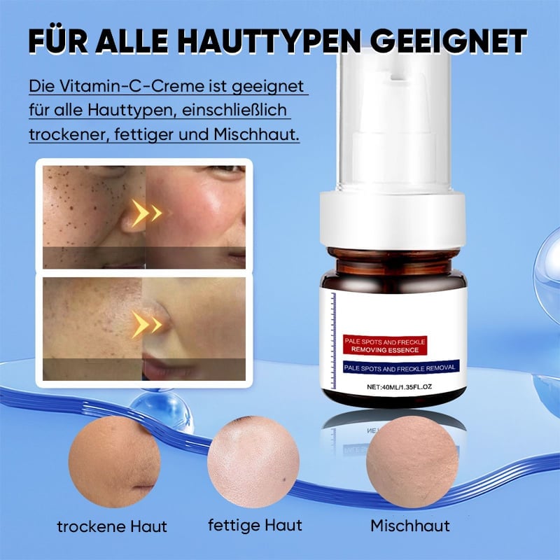 Vitamin C Aufhellende Gesichtscreme Gegen Sommersprossen