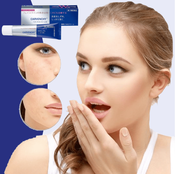 aacea80f-0ed1-42c8-a35d-57db5f250700