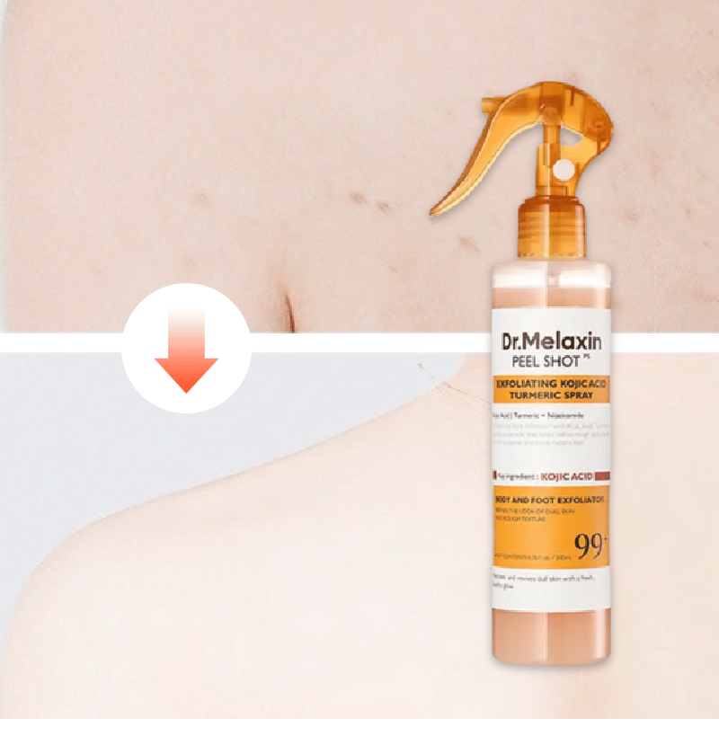 Keratinpleie Kojicsyre Gurkemeiespray