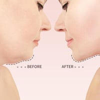 Lifting and firming face slimming bandage