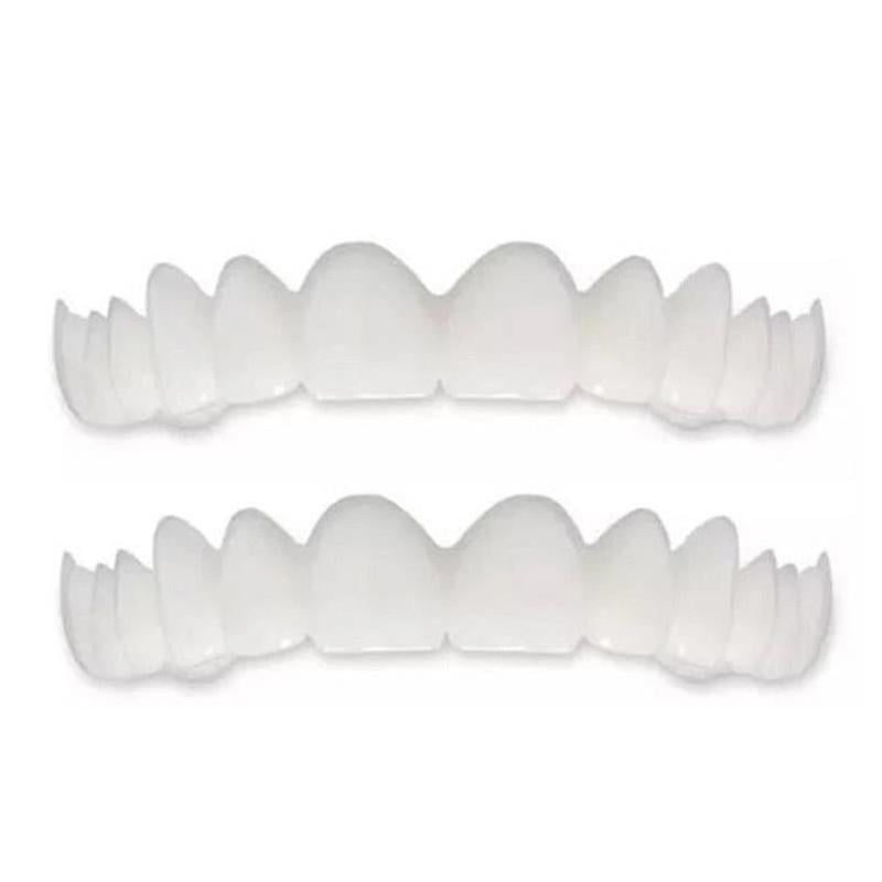 Zahnspange für Schönes Lächeln