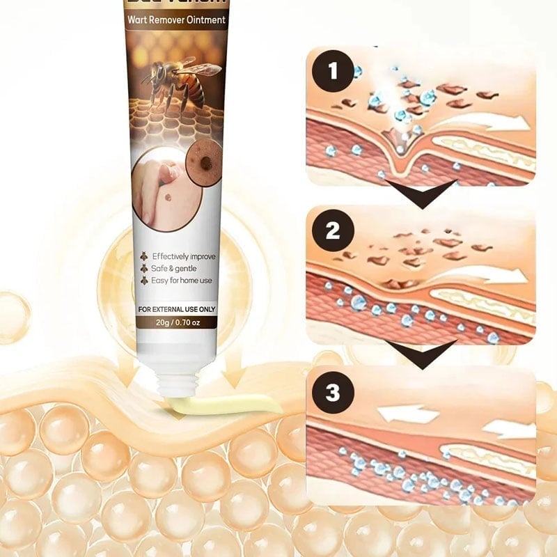 🌿 Anti-Wart/Skin Tag Cream 🩹
