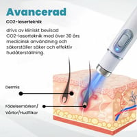 Icke-invasiv laserpenna för borttagning av vårtor och födelsemärken
