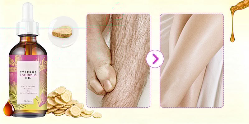 Before and after photos of a woman's leg showing hair reduction over 4 weeks