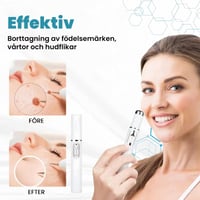 Icke-invasiv laserpenna för borttagning av vårtor och födelsemärken