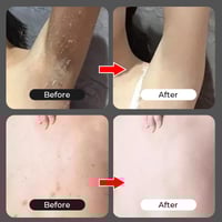 Lichaam Exfoliërende Nicotinamide-gel