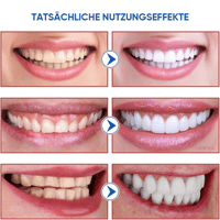 SP-8/SP-10 Probiotische Whitening-Zahnpasta für die Mundgesundheit