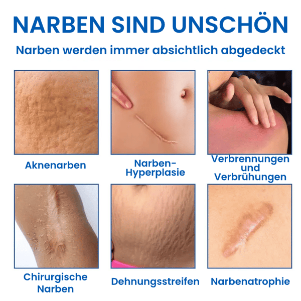 Professionelles Narbenentfernungsgel