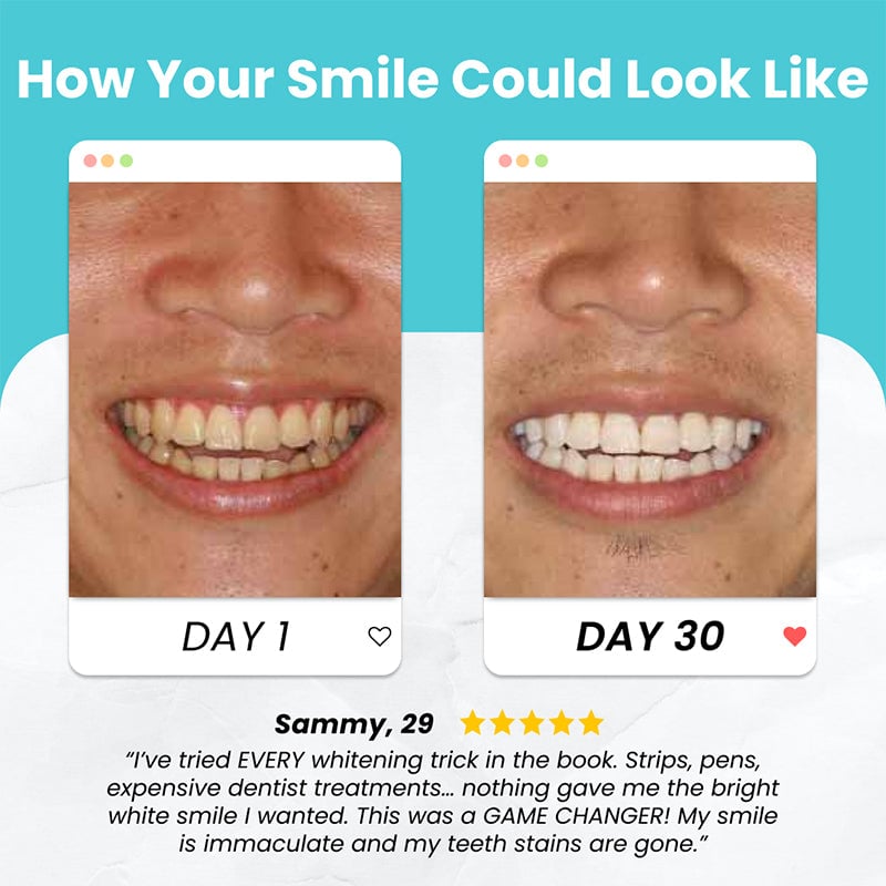 U Shaped Electric Toothbrush