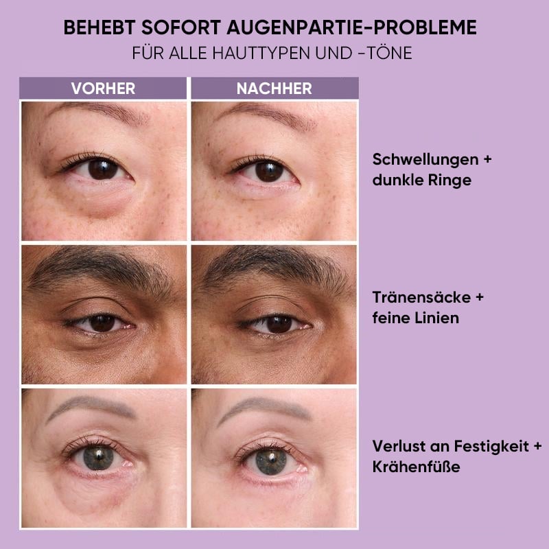 Lifting- und straffende Augencreme