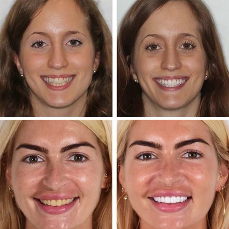 Vente incitative - Super Probiotic-6 Tandpasta