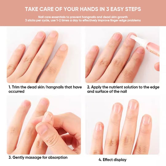 💅Hot Sale 49%OFF🔥Nails Nutritious Growth Oil