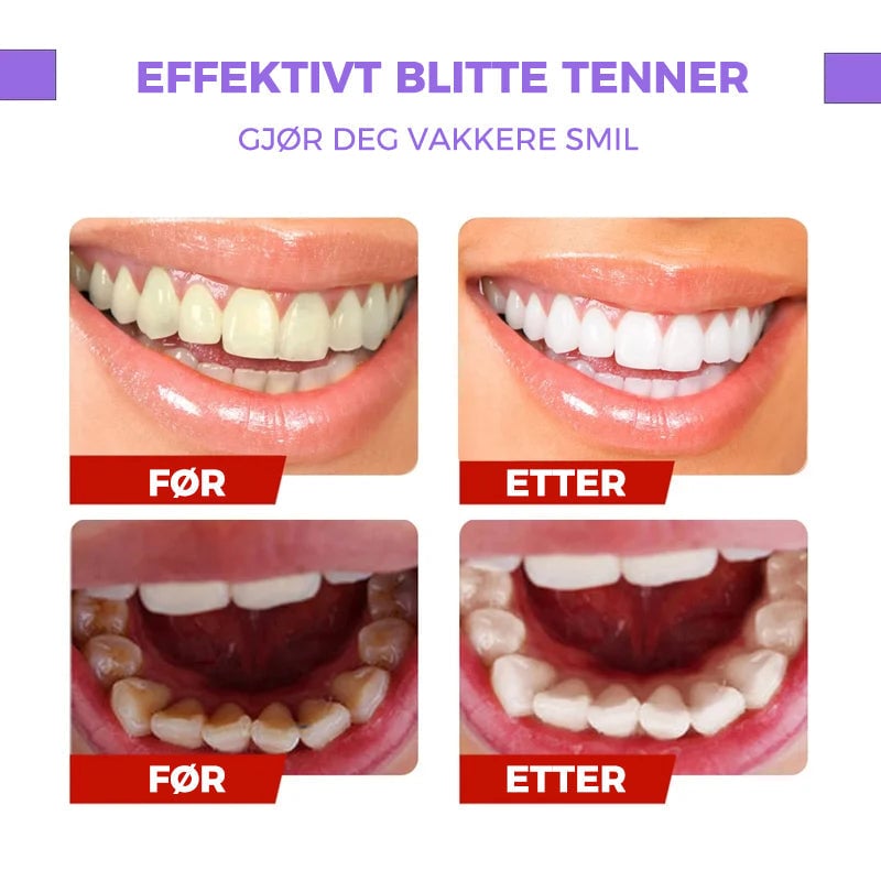 Tannfargekorrigerende serum