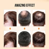 Hair Growth Oil