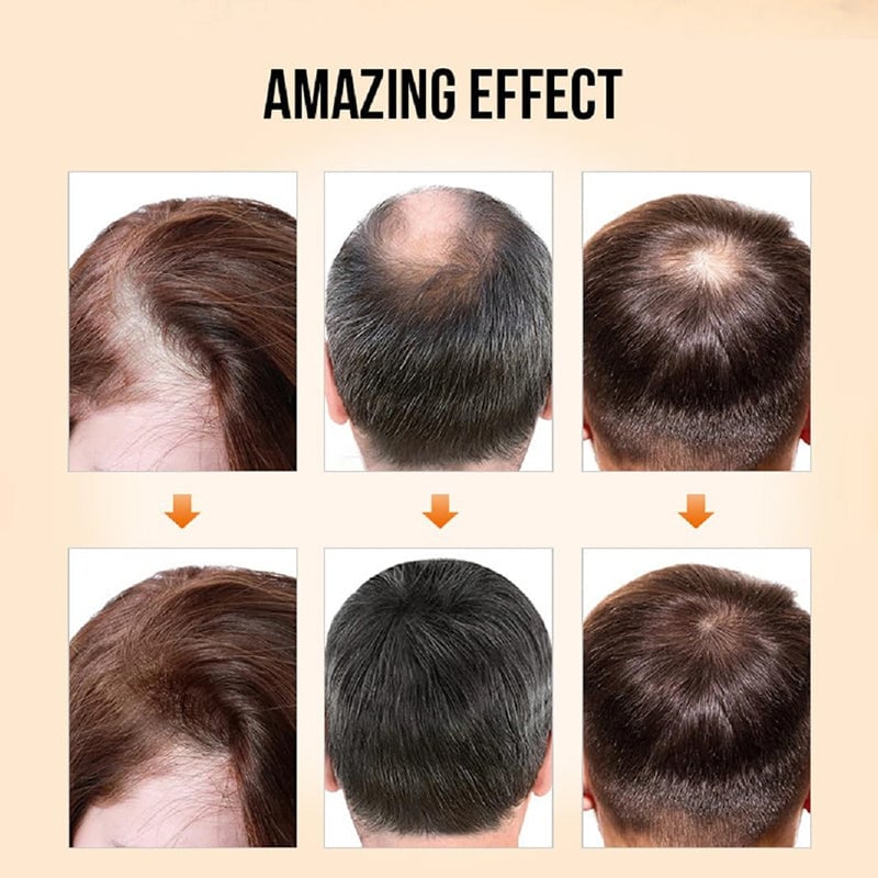 Hair Growth Oil
