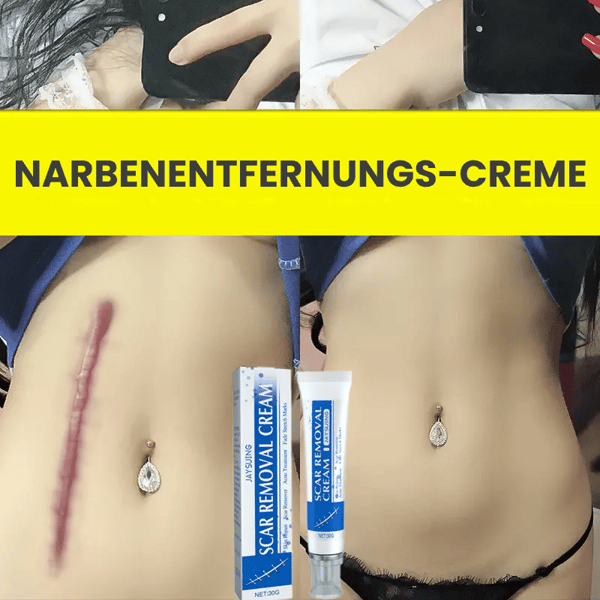 Professionelles Narbenentfernungsgel