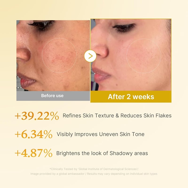 Kojic Acid Turmeric Toner for Face & Body