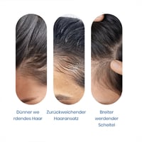 Hochwirksames Haarwachstums-Roll-On-Serum