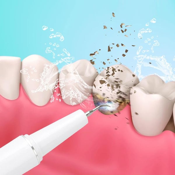 Ultrasonic Dental Cleaner