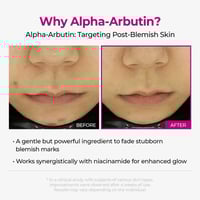 Intensive Discoloration Serum