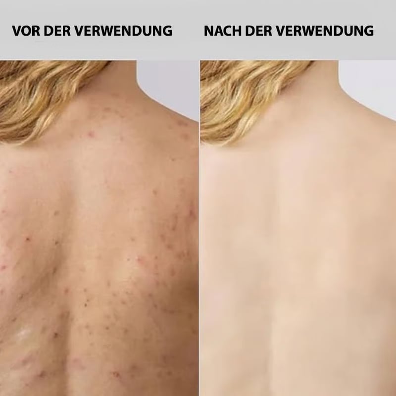 Peeling-Duschhandtuch