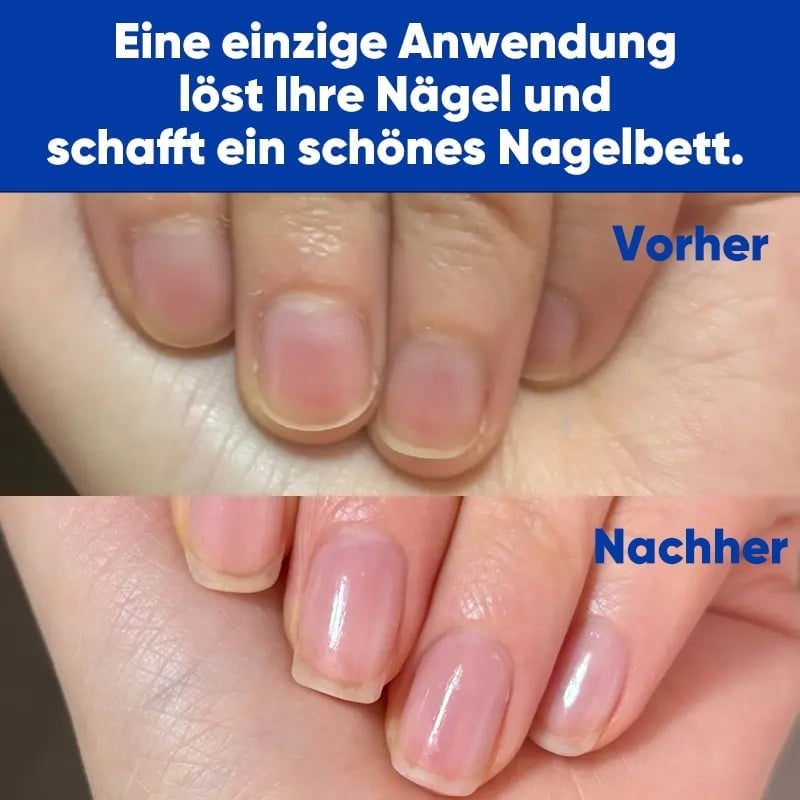 Antimykotische Nagelreparaturlösung