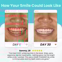U Shaped Electric Toothbrush