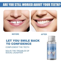 ✨ Moldable False Teeth for Temporary Tooth Fillings