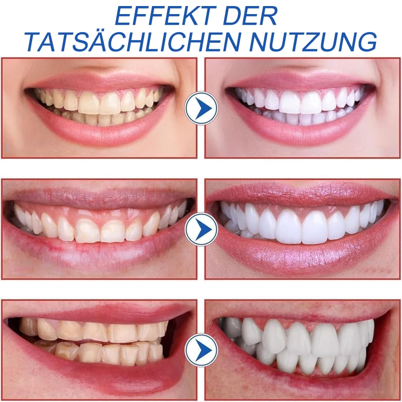 SP10 Probiotische Zahnpasta