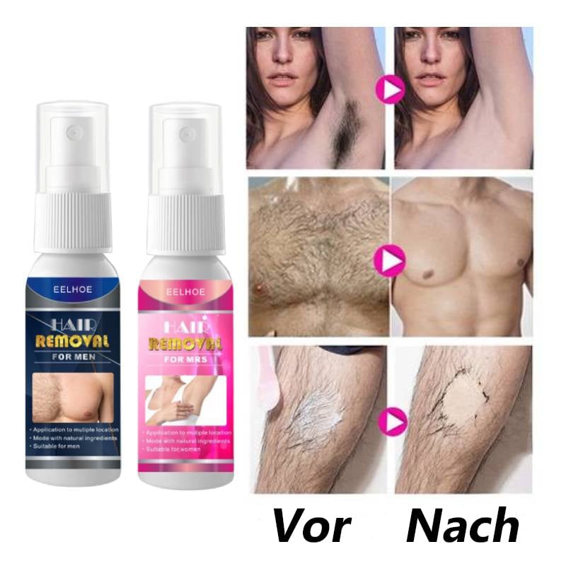 🎉Sommer-Specials🎉Kraftvolles und schmerzfreies Haarentfernungsspray