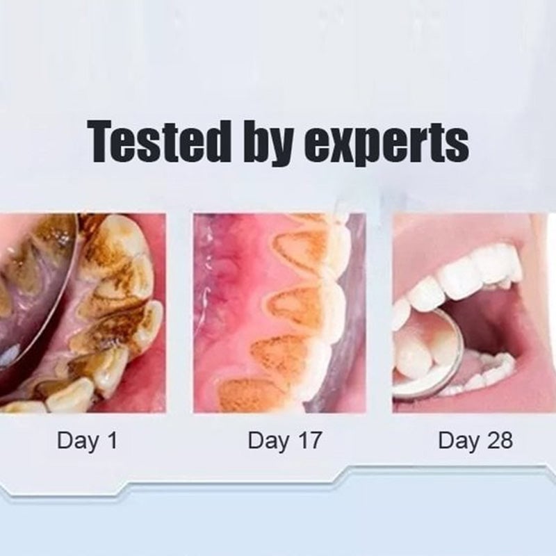 Super Probiotic-6 Toothpaste🔥buy 2 get1 free🔥
