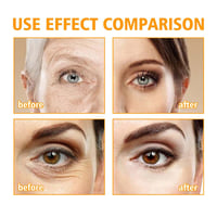Eye Care Cream