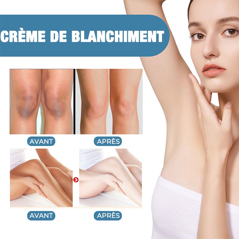 Crème Blanchissante Femme