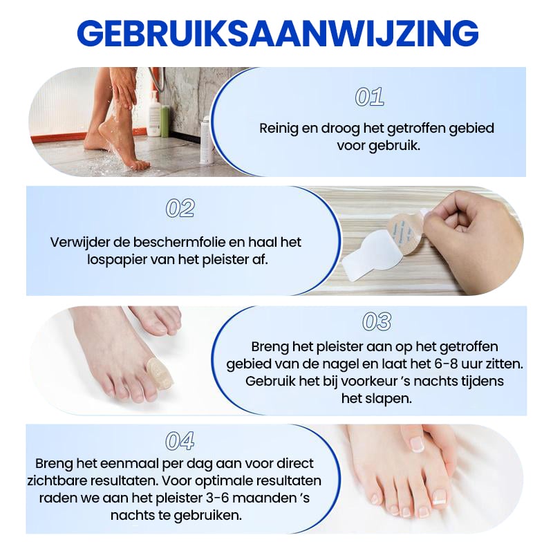 Schimmelnagelplekken