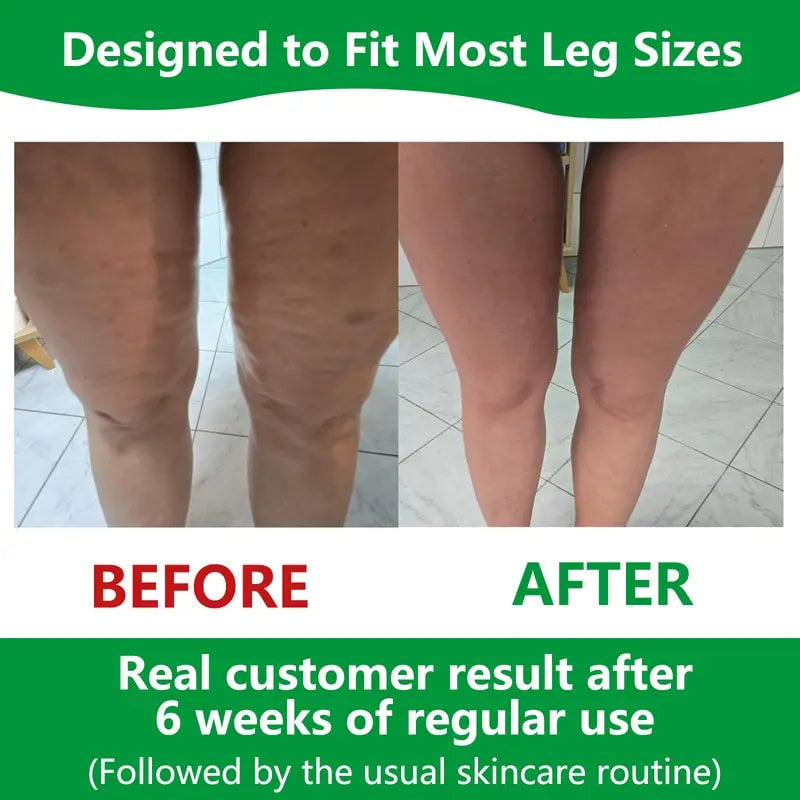 Cellulite Massage Roller