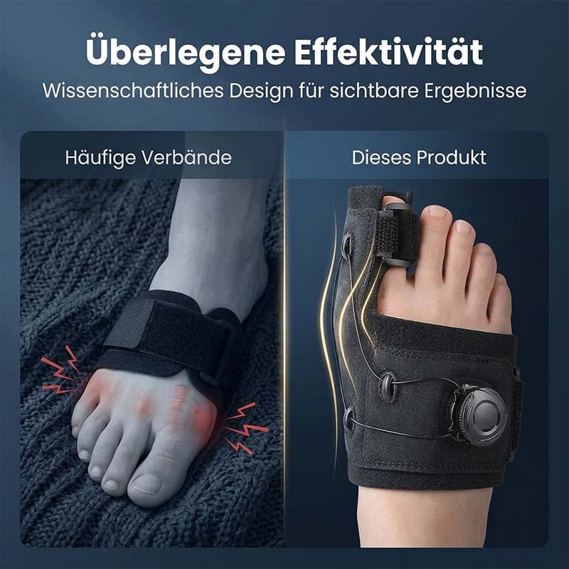 Verstellbarer Hallux Valgus Zehenkorrektor Knopf System Orthese