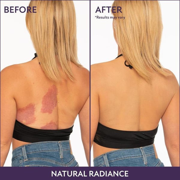 dc8f55c0-93b5-49bf-2622-53d06ee25000