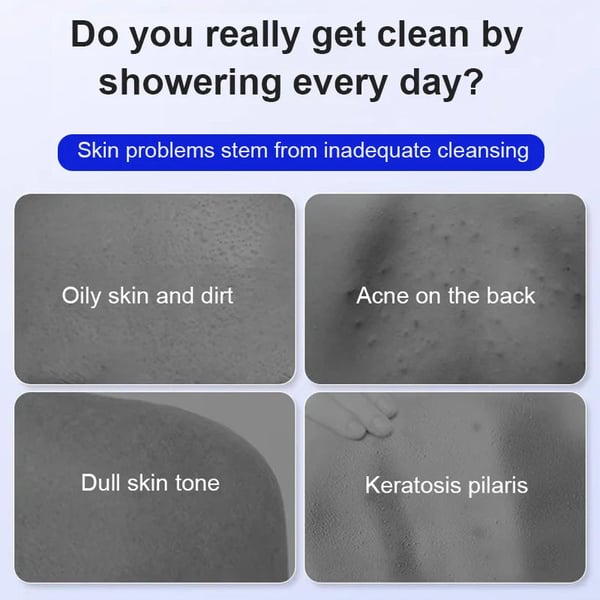 Lichaam Exfoliërende Nicotinamide-gel