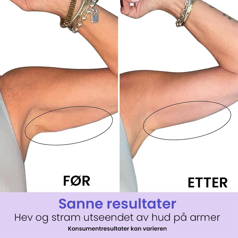 Formende Armkrem