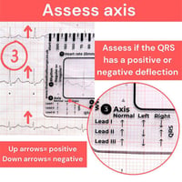 ECG 7 Step Ruler
