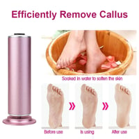 Electric Foot Callus Remover