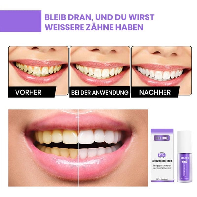 Zahnfarbkorrektur
