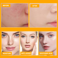 Turmeric Moisturizing Cream