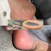 Exfoliërend Voetmasker