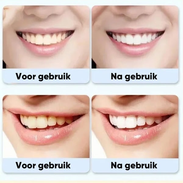 Super Probiotic-6 Tandpasta